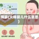 火棉婴(火棉婴儿什么意思)
