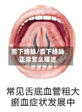 舌下络脉/舌下络脉正常怎么描述-第3张图片