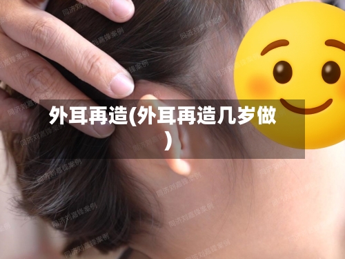 外耳再造(外耳再造几岁做)-第2张图片
