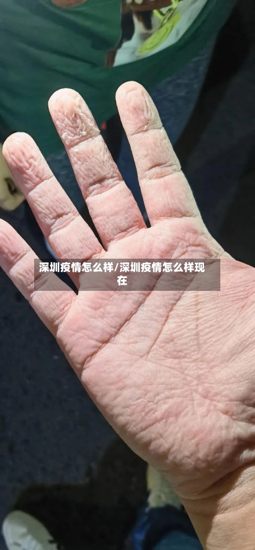 深圳疫情怎么样/深圳疫情怎么样现在-第1张图片